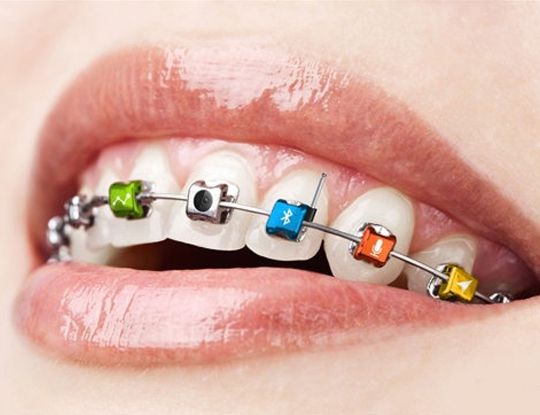 best orthodontist in gurgaon