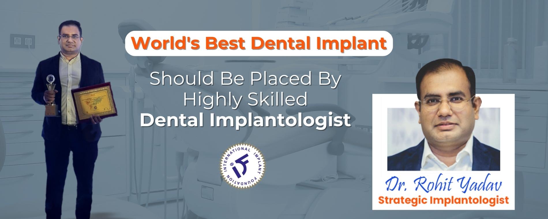 dr-rohit-yadv-dental-implantlogist
