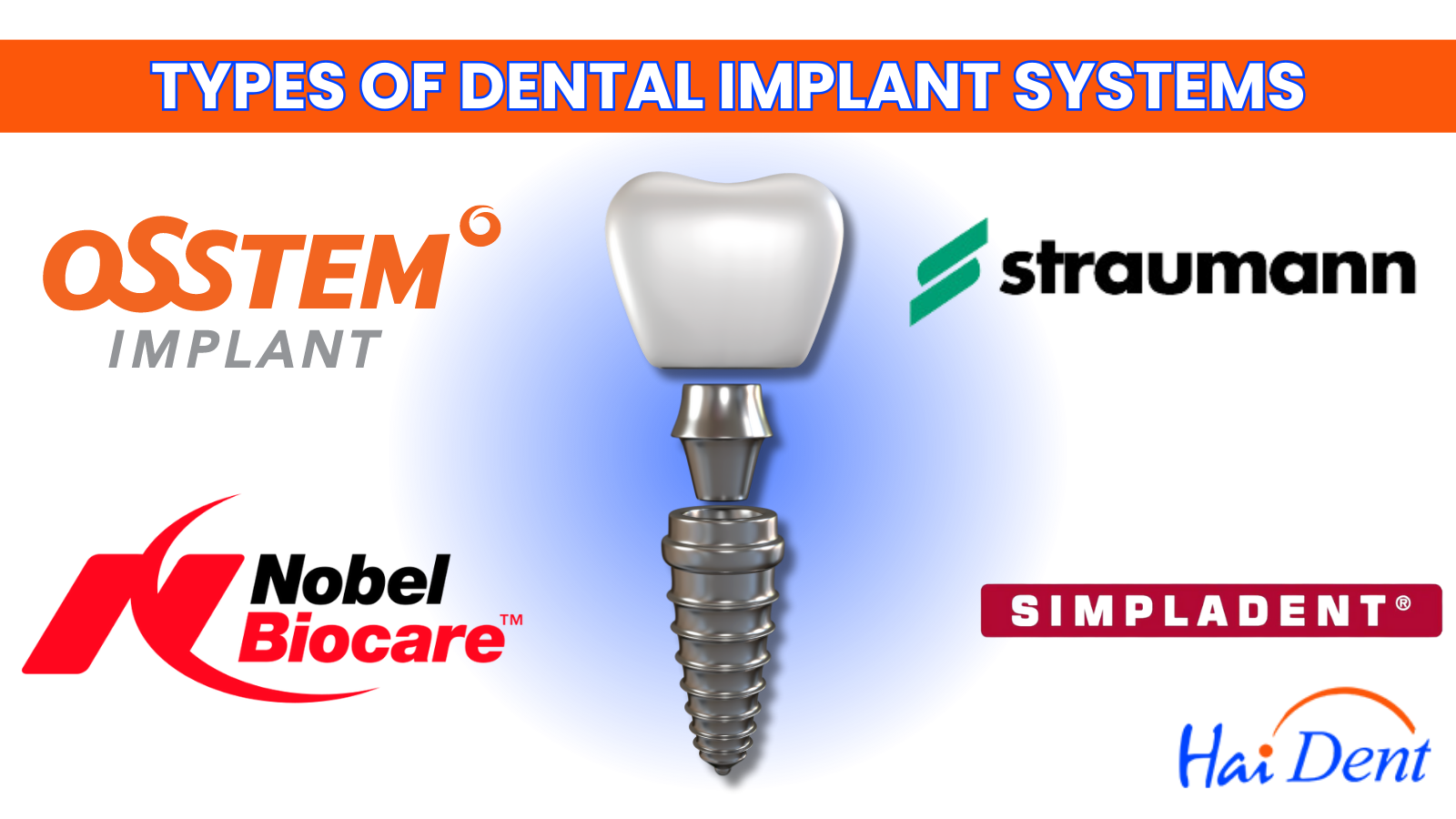 All-on-4 Dental Implants In India