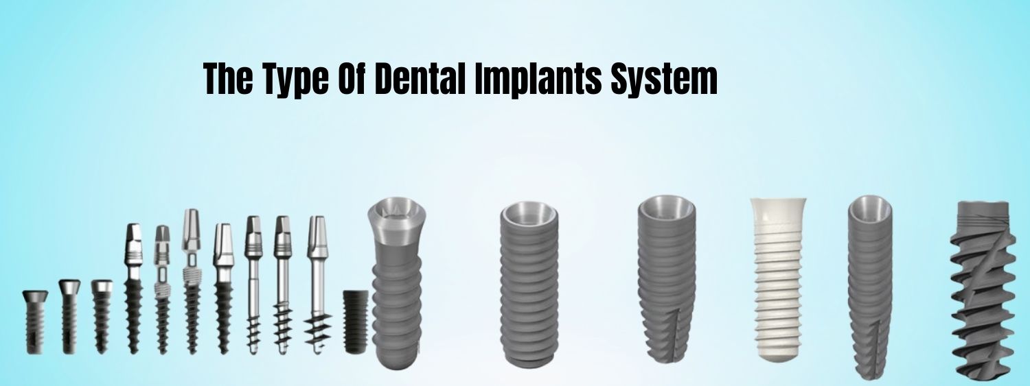 type of dental implant in delh