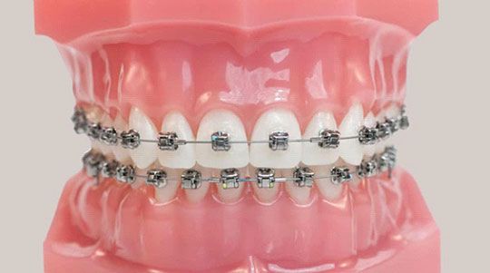 orthodontist in gurgaon