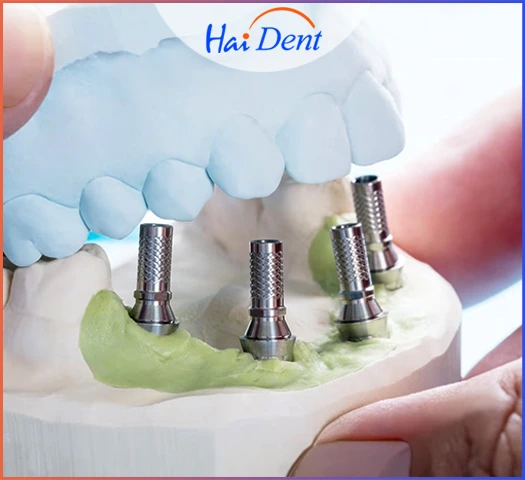 best dental clinic in india