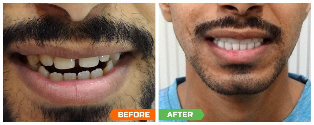 cosmetic dentist in gurgaon