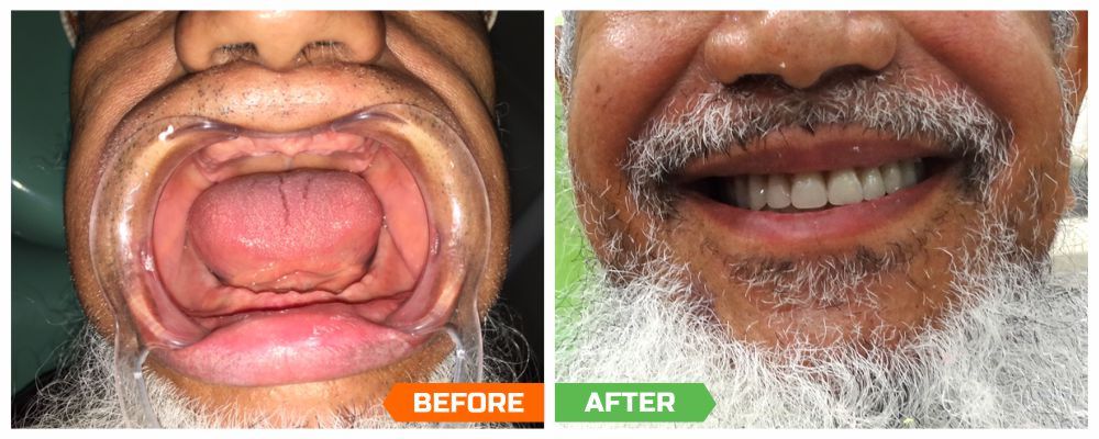 cosmetic dentist in mumbai