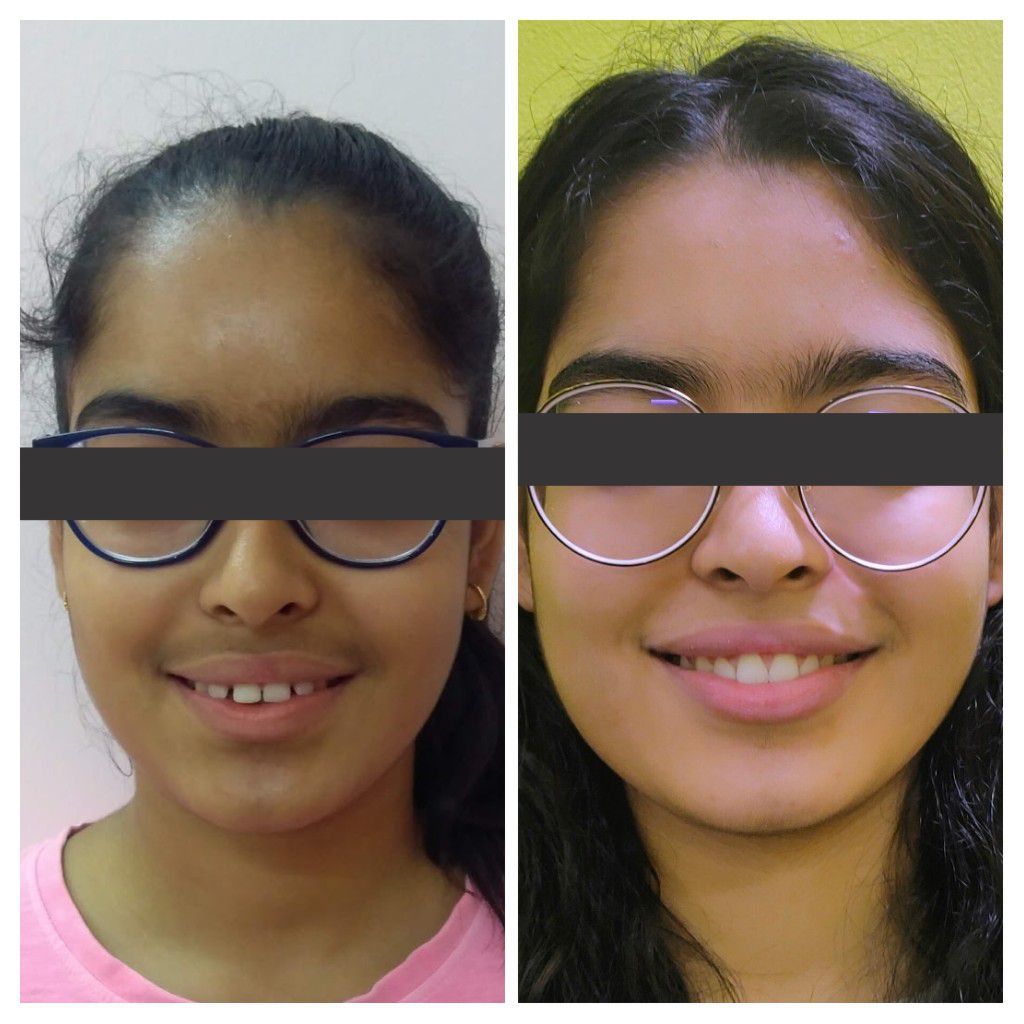 orthodontist in gurgaon