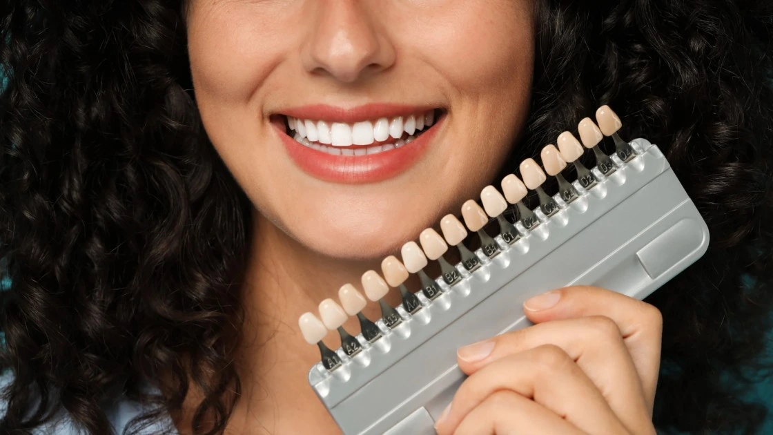 Beautiful smile makeover with Digital Smile Design at HaiDent