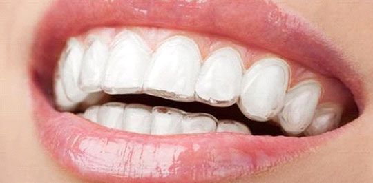 orthodontist in gurgaon