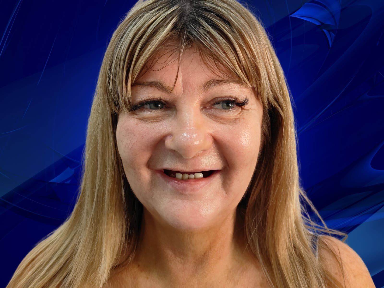 Cosmetic dentistry — beautiful smile after treatment at HaiDent before