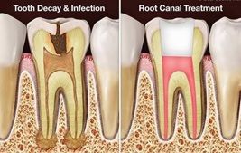 cosmetic dentist in mumbai