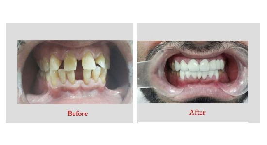 best orthodontist in mumbai